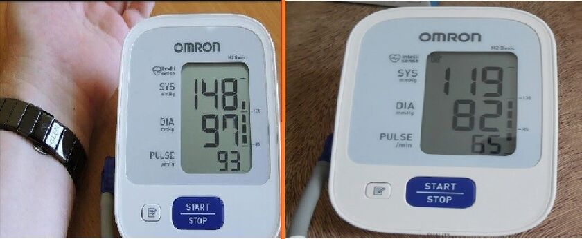 tanometer readings before and after taking Cardione